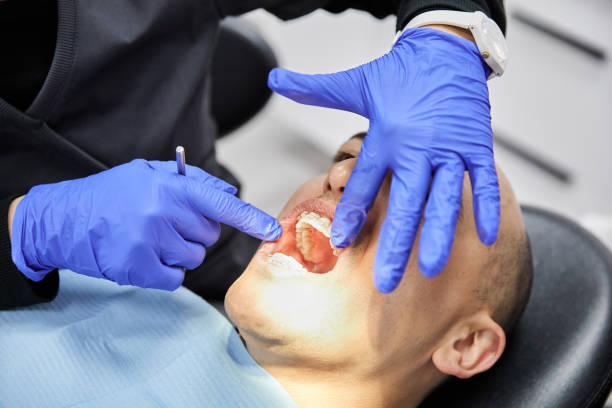 Best Emergency Dental Filling Replacement  in North Bellport, NY
